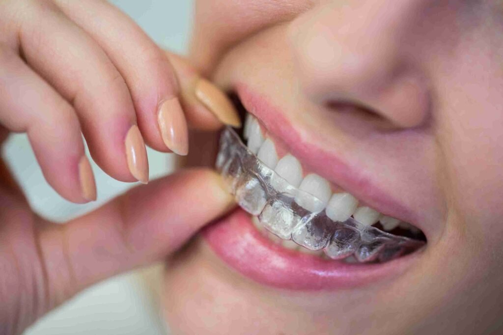 Invisalign untuk Gigi Tonggos, Solusi Rapi Tanpa Kawat